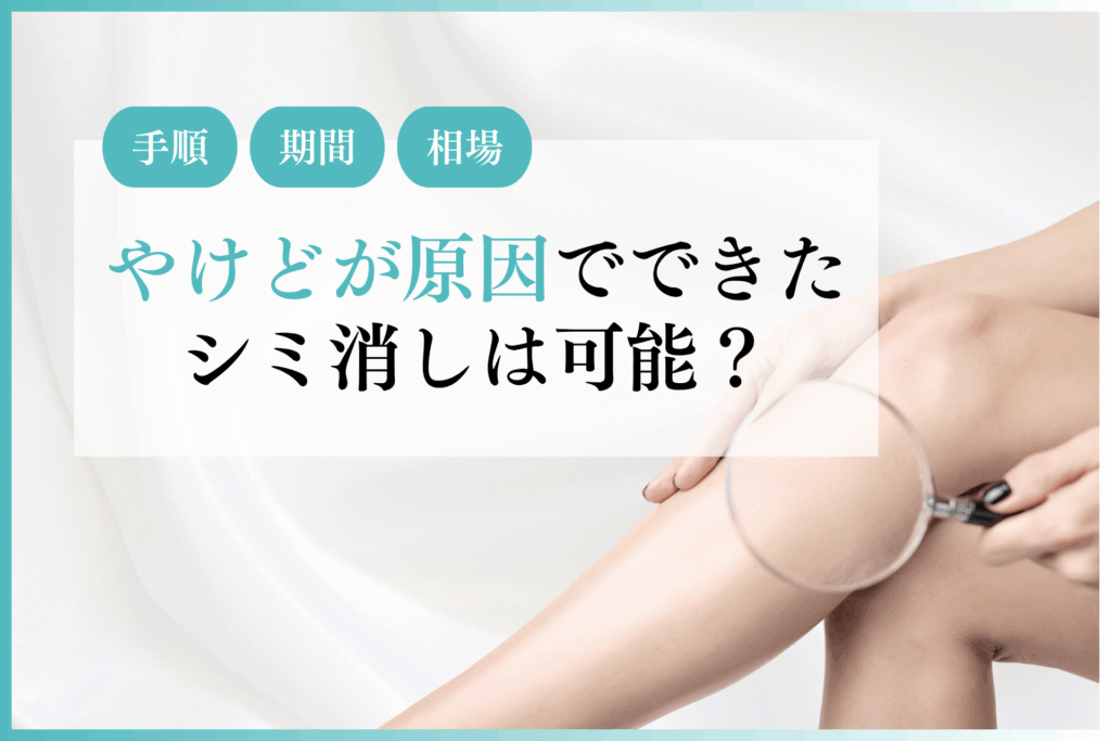 やけどが原因でできたシミ消しは可能？手順や期間から費用相場の目安