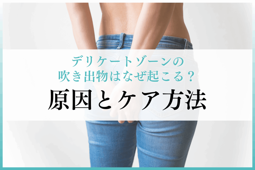 デリケートゾーンの吹き出物はなぜ起こる？原因とケア方法を徹底解説