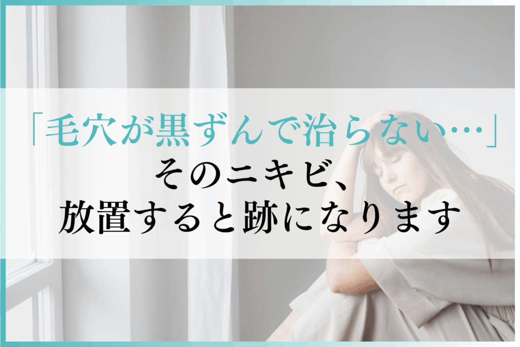 「毛穴が黒ずんで治らない…」そのニキビ、放置すると跡になります｜正しい対処法とは？