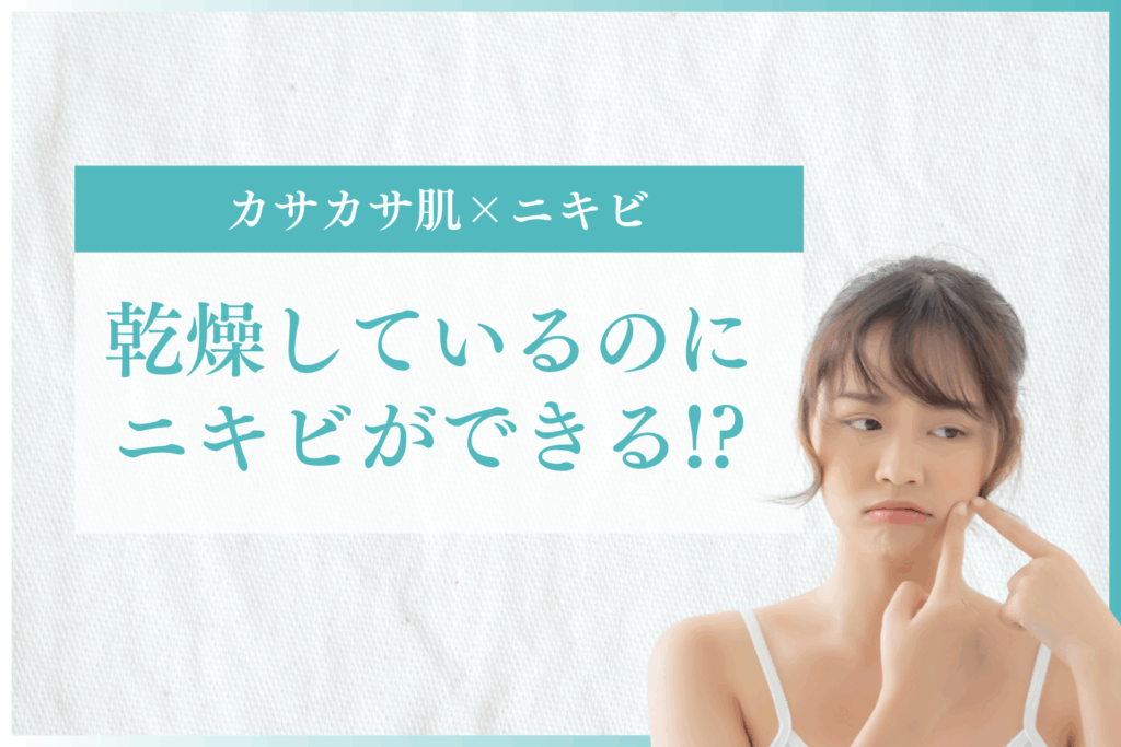 乾燥しているのにニキビができる!?カサカサ肌×ニキビの原因と正しいスキンケア対策