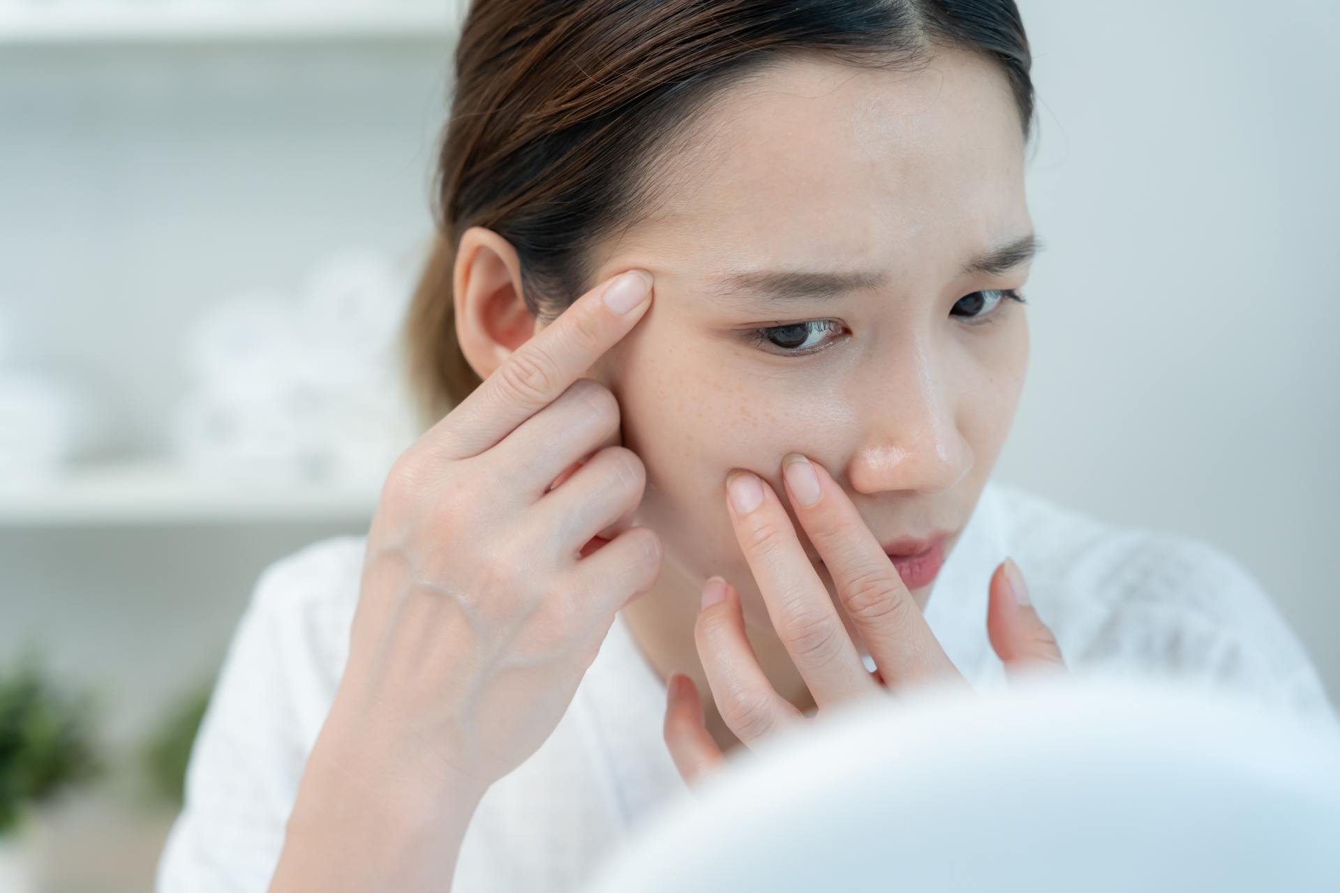 日焼け止めで肌荒れしやすい人の特徴