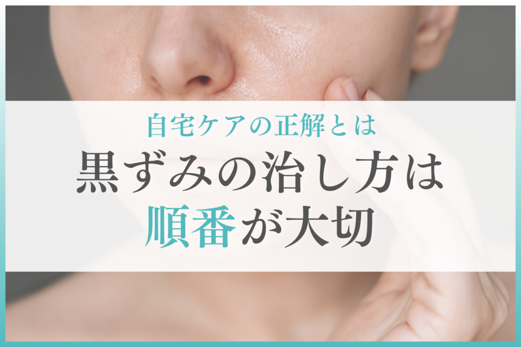 黒ずみの治し方は順番が大切｜自宅ケアの正解とは
